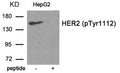 Western blot analysis of extracts from HepG2 tissue using HER2 (Phospho-Tyr1112) antibody.The lane on the right is treated with the antigen-specific peptide.