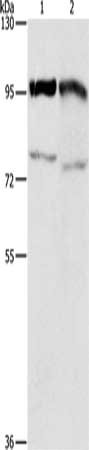Gel: 8%SDS-PAGE, Lysate: 40 ug, Lane 1-2: Raji cells, K562 cells, Primary antibody: CSB-PA761728(EZH2 Antibody) at dilution 1/350, Secondary antibody: Goat anti rabbit IgG at 1/8000 dilution, Exposure time: 1 minute