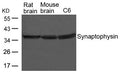 Western blot analysis of extracts from Rat and Mouse brain tissue and C6 cells using Synaptophysin Antibody.
