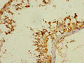 ANKS1B Antibody – Figure 1 of 2