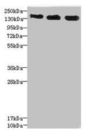 Western blot All lanes: ANKS1B antibody at 5.28µg/ml Lane 1: 293T whole cell lysate Lane 2: HepG2 whole cell lysate Lane 3: Hela whole cell lysate Secondary Goat polyclonal to rabbit IgG at 1/10000 dilution Predicted band size: 139, 49, 58, 53, 52, 86, 48, 41, 29, 45 kDa Observed band size: 139 kDa