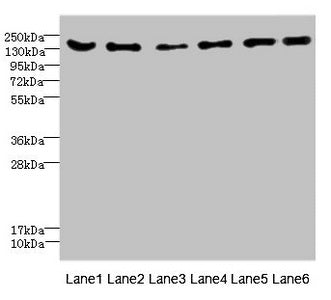 Western blot All lanes: CD1C antibody at 4.61ug/ml Lane 1: Mouse brain tissue Lane 2: Mouse lung tissue Lane 3: 293T whole cell lysate Lane 4: HepG2 whole cell lysate Lane 5: Jurkat whole cell lysate Lane 6: Hela whole cell lysate Secondary Goat polyclonal to rabbit IgG at 1/10000 dilution Predicted band size: 137, 134, 140 kDa Observed band size: 137 kDa