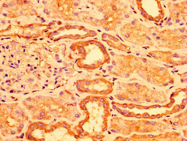 IHC image of CSB-PA768206LA01HU diluted at 1:300 and staining in paraffin-embedded human kidney tissue performed on a Leica BondTM system. After dewaxing and hydration, antigen retrieval was mediated by high pressure in a citrate buffer (pH 6.0). Section was blocked with 10% normal goat serum 30min at RT. Then primary antibody (1% BSA) was incubated at 4&deg;C overnight. The primary is detected by a biotinylated secondary antibody and visualized using an HRP conjugated SP system.