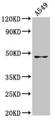 Western Blot
Positive WB detected in: A549 whole cell lysate
All lanes: GDF7 antibody at 7.9µg/ml
Secondary
Goat polyclonal to rabbit IgG at 1/50000 dilution
Predicted band size: 47 kDa
Observed band size: 47 kDa