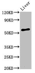 Western Blot
Positive WB detected in: Rat liver tissue
All lanes: AMIGO2 antibody at 3.2µg/ml
Secondary
Goat polyclonal to rabbit IgG at 1/50000 dilution
Predicted band size: 58 kDa
Observed band size: 58 kDa