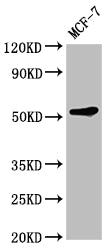 Western Blot
Positive WB detected in: MCF-7 whole cell lysate
All lanes: KMT5C antibody at 1:2000
Secondary
Goat polyclonal to rabbit IgG at 1/50000 dilution
Predicted band size: 53 kDa
Observed band size: 53 kDa