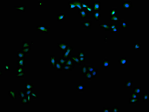 Immunofluorescence staining of Hela cells with CSB-PA769808LA21HU at 1:100, counter-stained with DAPI. The cells were fixed in 4% formaldehyde and blocked in 10% normal Goat Serum. The cells were then incubated with the antibody overnight at 4°C. The secondary antibody was Alexa Fluor 488-congugated AffiniPure Goat Anti-Rabbit IgG(H+L).