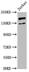Western Blot
Positive WB detected in: Jurkat whole cell lysate
All lanes: CASZ1 antibody at 4.8ug/ml
Secondary
Goat polyclonal to rabbit IgG at 1/50000 dilution
Predicted band size: 191, 125 kDa
Observed band size: 191 kDa