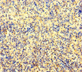 Immunohistochemistry of paraffin-embedded human spleen tissue using CSB-PA773048LA01HU at dilution of 1:100
