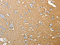 The image on the left is immunohistochemistry of paraffin-embedded Human brain tissue using CSB-PA773563(SLC4A4 Antibody) at dilution 1/50, on the right is treated with fusion protein. (Original magnification: ×200)