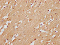 IHC image of CSB-PA774793LA01HU diluted at 1:200 and staining in paraffin-embedded human brain tissue performed on a Leica BondTM system. After dewaxing and hydration, antigen retrieval was mediated by high pressure in a citrate buffer (pH 6.0). Section was blocked with 10% normal goat serum 30min at RT. Then primary antibody (1% BSA) was incubated at 4°C overnight. The primary is detected by a Goat anti-rabbit polymer IgG labeled by HRP and visualized using 0.05% DAB.
