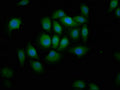 Immunofluorescence staining of A549 cells with CSB-PA774804LA01HU at 1:166, counter-stained with DAPI. The cells were fixed in 4% formaldehyde, permeabilized using 0.2% Triton X-100 and blocked in 10% normal Goat Serum. The cells were then incubated with the antibody overnight at 4&deg;C. The secondary antibody was Alexa Fluor 488-congugated AffiniPure Goat Anti-Rabbit IgG(H+L).