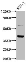 Western Blot
Positive WB detected in: MCF-7 whole cell lysate
All lanes: LAPTM4B antibody at 4.8ug/ml
Secondary
Goat polyclonal to rabbit IgG at 1/50000 dilution
Predicted band size: 42, 26, 36 kDa
Observed band size: 42 kDa