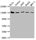 Western Blot
Positive WB detected in: Hela whole cell lysate, Jurkat whole cell lysate, 293T whole cell lysate, HepG2 whole cell lysate, MCF-7 whole cell lysate
All lanes: CAND1 antibody at 4.9µg/ml
Secondary
Goat polyclonal to rabbit IgG at 1/50000 dilution
Predicted band size: 137, 118, 46 kDa
Observed band size: 137 kDa
