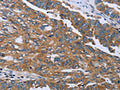 GAB2 Antibody – Figure 1 of 3