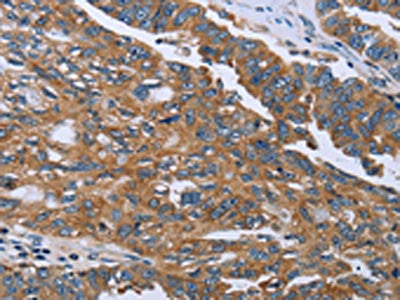 GAB2 Antibody – Figure 1 of 3