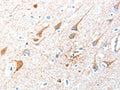 The image on the left is immunohistochemistry of paraffin-embedded Human brain tissue using CSB-PA775649(AKT3 Antibody) at dilution 1/40, on the right is treated with synthetic peptide. (Original magnification: ×200)