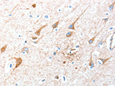 The image on the left is immunohistochemistry of paraffin-embedded Human brain tissue using CSB-PA775649(AKT3 Antibody) at dilution 1/40, on the right is treated with synthetic peptide. (Original magnification: ×200)