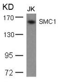 Western blot analysis of extracts from JK cells using SMC1(Ab-957) Antibody.