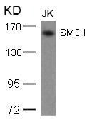 Western blot analysis of extracts from JK cells using SMC1(Ab-957) Antibody.
