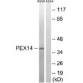 Western blot analysis of extracts from A549 cells, using PEX14 antibody.