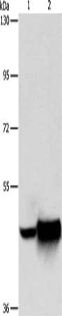 Gel: 8%SDS-PAGE, Lysate: 60 ug, Lane 1-2: A172 cells, hela cells, Primary antibody: CSB-PA776085(MAPT Antibody) at dilution 1/150, Secondary antibody: Goat anti rabbit IgG at 1/8000 dilution, Exposure time: 40 seconds