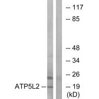 Western blot analysis of extracts from A549 cells, using ATP5L2 antibody.