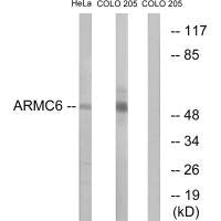 Western blot analysis of extracts from HeLa cells and COLO cells, using ARMC6 antibody.