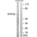 Western blot analysis of extracts from COLO cells, using STK39 (Ab-325) antibody.