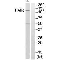 Western blot analysis of extracts from 293 cells, using HAIR antibody.
