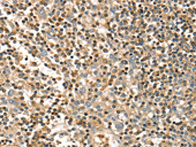 The image on the left is immunohistochemistry of paraffin-embedded Human tonsil tissue using CSB-PA776528(FMNL1 Antibody) at dilution 1/20, on the right is treated with fusion protein. (Original magnification: ×200)