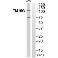 Western blot analysis of extracts from LOVO cells, using TM16G antiobdy.