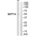 Western blot analysis of extracts from NIH/3T3 cells, using SEPT14 antibody.