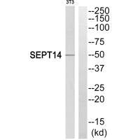 Western blot analysis of extracts from NIH/3T3 cells, using SEPT14 antibody.
