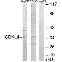 Western blot analysis of extracts from HepG2 cells and COLO205 cells, using CDKL4 antibody.