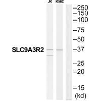 Western blot analysis of extracts from JK cells and K562 cells, using SLC9A3R2 antibody.