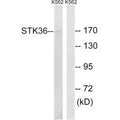 Western blot analysis of extracts from K562 cells, using STK36 antibody.
