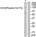 Western blot analysis of extracts from JK cells using VAV3 (Phospho-Tyr173) Antibody.The lane on the right is treated with the antigen-specific peptide.