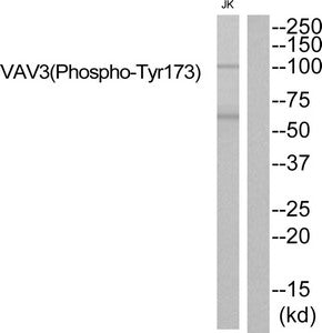 Western blot analysis of extracts from JK cells using VAV3 (Phospho-Tyr173) Antibody.The lane on the right is treated with the antigen-specific peptide.