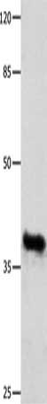 GDF15 Antibody – Figure 1 of 1