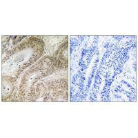 Immunohistochemistry analysis of paraffin-embedded human colon carcinoma tissue using RDM1 antibody.