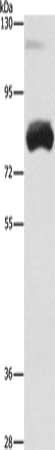 Gel: 10%SDS-PAGE, Lysate: 40 ug, Lane: Mouse heart tissue, Primary antibody: CSB-PA780177(OAS2 Antibody) at dilution 1/300, Secondary antibody: Goat anti rabbit IgG at 1/8000 dilution, Exposure time: 10 seconds