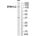 Western blot analysis of extracts from K562 cells, using EPB41L2 antibody.