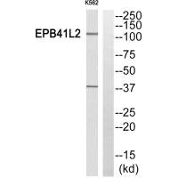 Western blot analysis of extracts from K562 cells, using EPB41L2 antibody.
