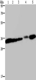 Gel: 10%SDS-PAGE, Lysate: 40 ug, Lane 1-5: HUVEC cells, 293T cells, mouse bladder tissue, human placenta tissue, mouse kidney tissue, Primary antibody: CSB-PA780406(CLDN23 Antibody) at dilution 1/200, Secondary antibody: Goat anti rabbit IgG at 1/8000 dilution, Exposure time: 40 seconds