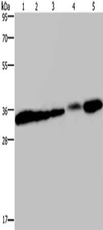 Gel: 10%SDS-PAGE, Lysate: 40 ug, Lane 1-5: HUVEC cells, 293T cells, mouse bladder tissue, human placenta tissue, mouse kidney tissue, Primary antibody: CSB-PA780406(CLDN23 Antibody) at dilution 1/200, Secondary antibody: Goat anti rabbit IgG at 1/8000 dilution, Exposure time: 40 seconds