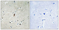 Immunohistochemical analysis of paraffin-embedded human brain tissue using PDK1 (Phospho-Tyr9) antibody (left)or the same antibody preincubated with blocking peptide (right).