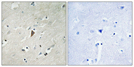 Immunohistochemical analysis of paraffin-embedded human brain tissue using PDK1 (Phospho-Tyr9) antibody (left)or the same antibody preincubated with blocking peptide (right).