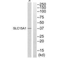 Western blot analysis of extracts from Jurkat cells, using SLC15A1 antibody.
