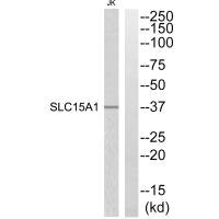 Western blot analysis of extracts from Jurkat cells, using SLC15A1 antibody.